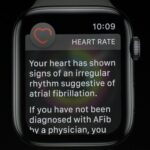 Apple secures victory in patent battle with AliveCor