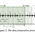 AirPods as the future of heart rate monitoring